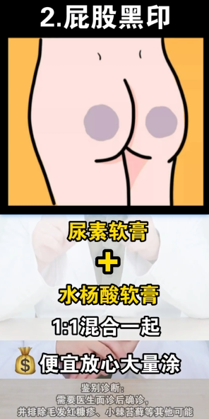 身上的黑印 去除3589 作者:小猪妖 帖子ID:79 身上,去除