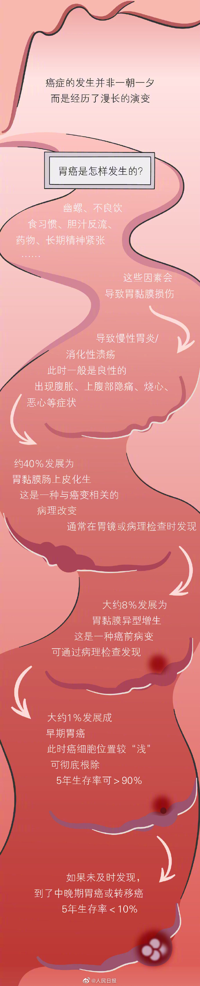 胃癌几乎都是吃出来的2429 作者:小猪妖 帖子ID:430 
