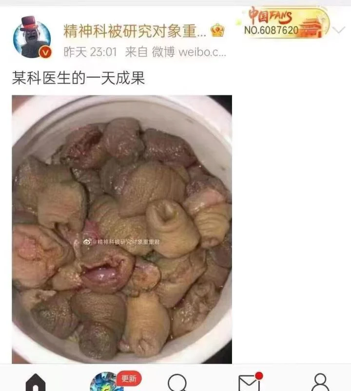 割包皮，某科医生的一天成果...7030 作者:东篱 帖子ID:1009 